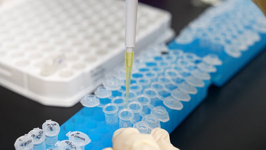 Can Resveratrol Change the Way We Manage Kidney Disease?